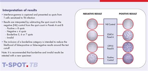 tb test results images